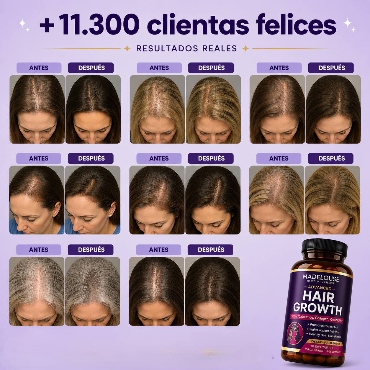 Advanced Hair Growth | Recupera la confianza desde la raíz