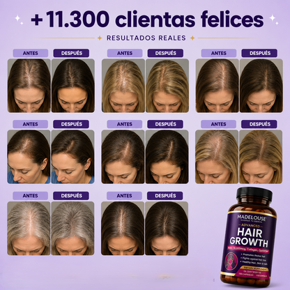 Advanced Hair Growth | Recupera la confianza desde la raíz